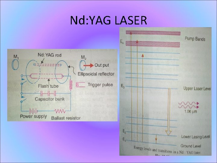 Nd: YAG LASER 
