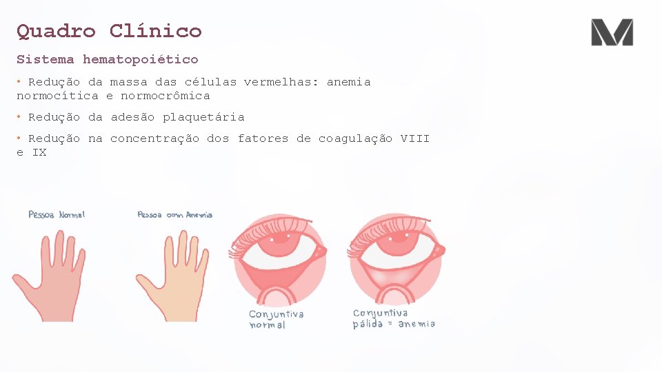 Quadro Clínico Sistema hematopoiético • Redução da massa das células vermelhas: anemia normocítica e Quadro Clínico Sistema hematopoiético • Redução da massa das células vermelhas: anemia normocítica e