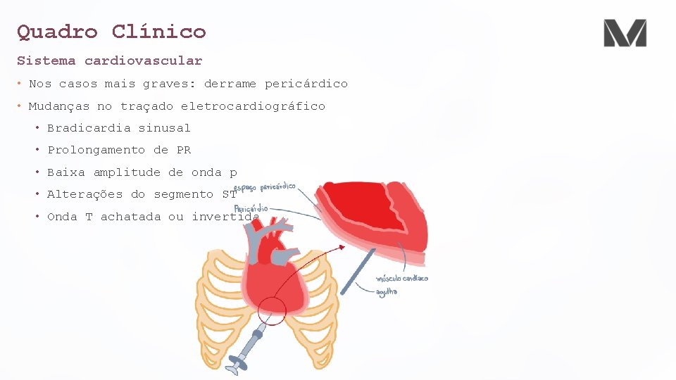 Quadro Clínico Sistema cardiovascular • Nos casos mais graves: derrame pericárdico • Mudanças no Quadro Clínico Sistema cardiovascular • Nos casos mais graves: derrame pericárdico • Mudanças no