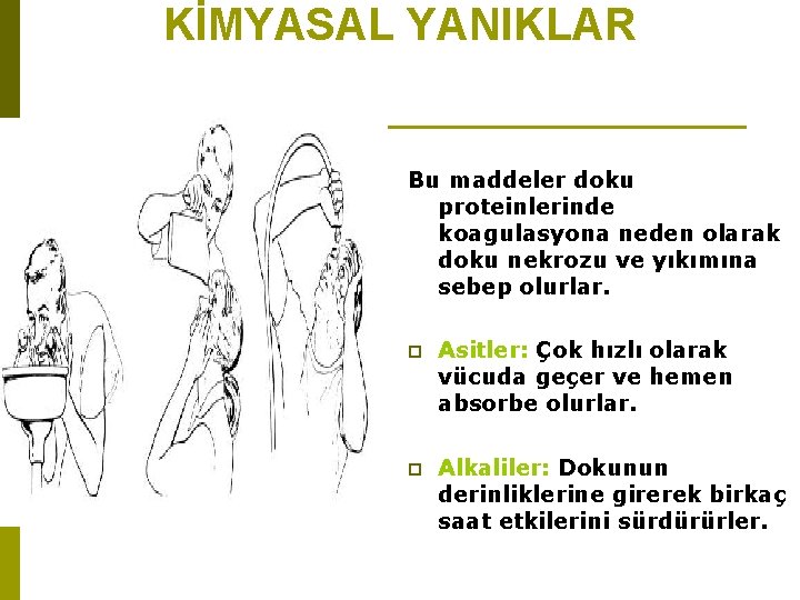 KİMYASAL YANIKLAR Bu maddeler doku proteinlerinde koagulasyona neden olarak doku nekrozu ve yıkımına sebep