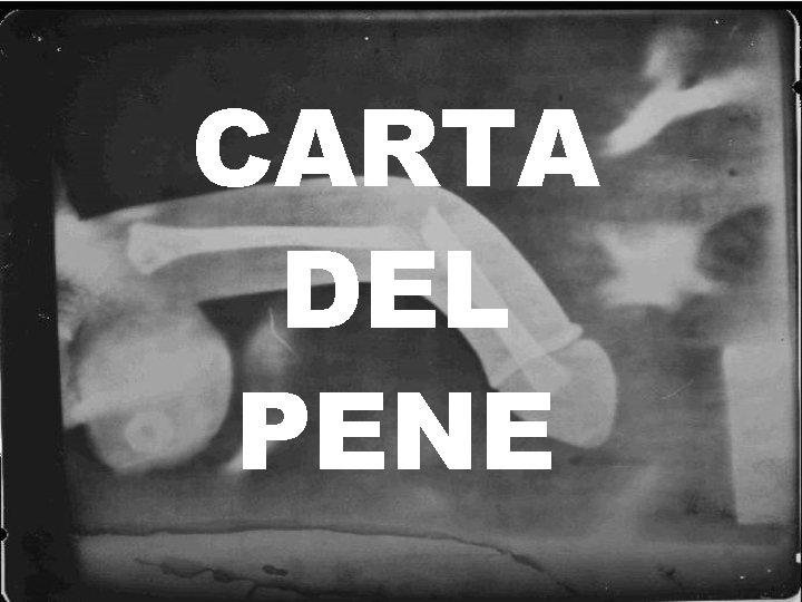 CARTA DEL PENE 