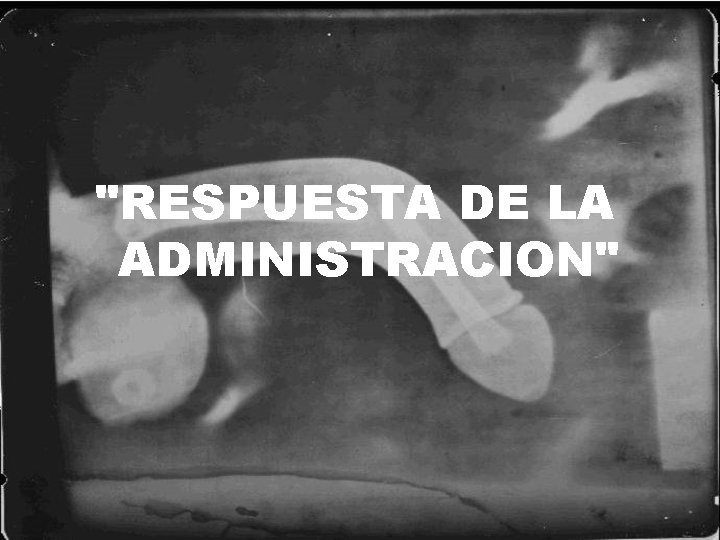 "RESPUESTA DE LA ADMINISTRACION" 