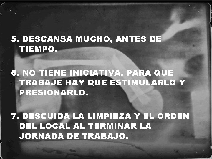 5. DESCANSA MUCHO, ANTES DE TIEMPO. 6. NO TIENE INICIATIVA. PARA QUE TRABAJE HAY