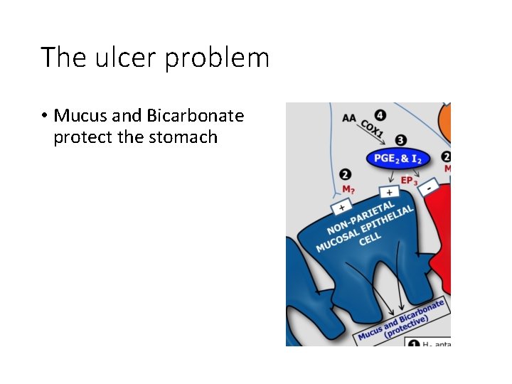 The ulcer problem • Mucus and Bicarbonate protect the stomach 