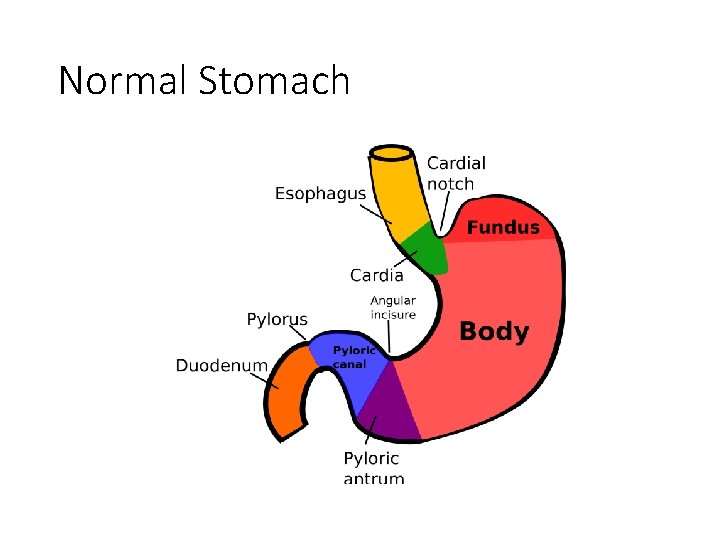 Normal Stomach 