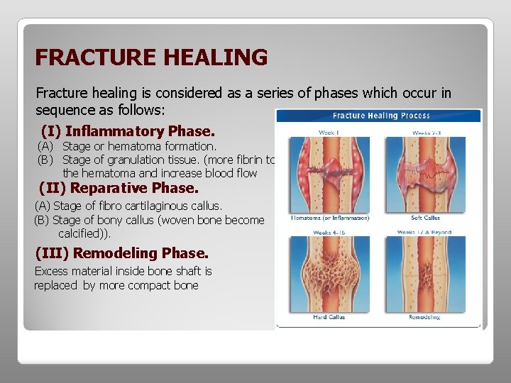 FRACTURE HEALING Fracture healing is considered as a series of phases which occur in