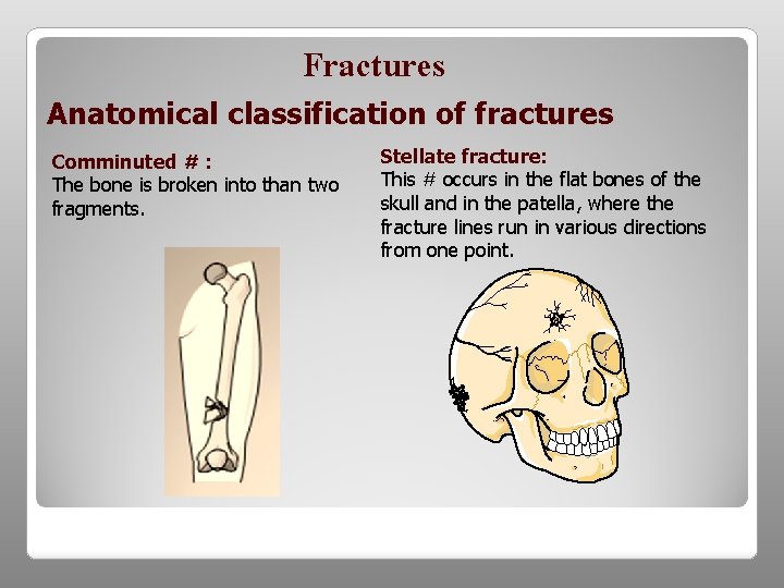Fractures Anatomical classification of fractures Comminuted # : The bone is broken into than