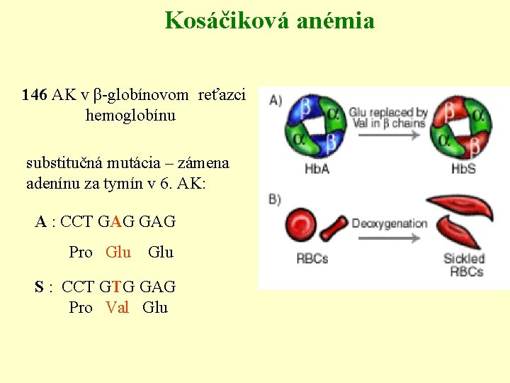 Kosáčiková anémia 146 AK v β-globínovom reťazci hemoglobínu substitučná mutácia – zámena adenínu za