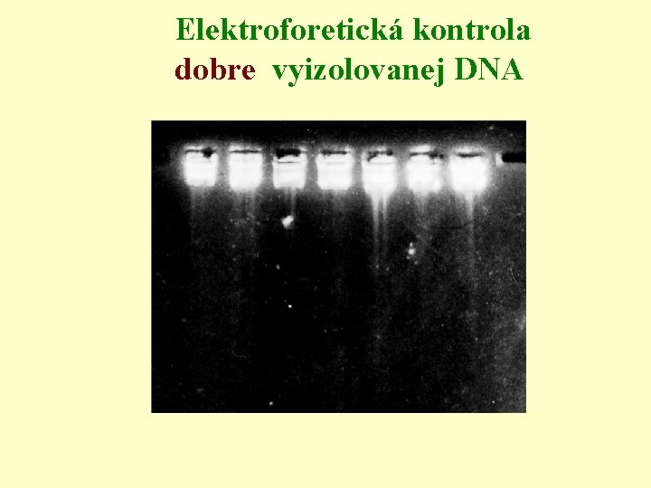 Elektroforetická kontrola dobre vyizolovanej DNA 