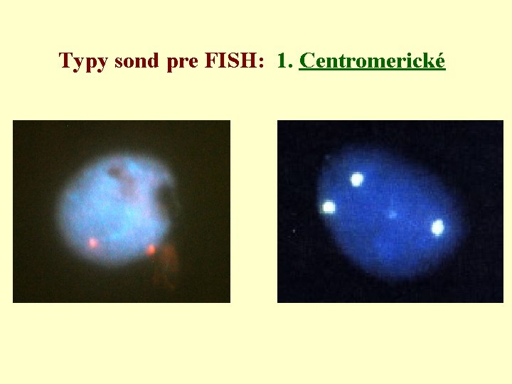 Typy sond pre FISH: 1. Centromerické 