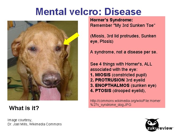 Mental velcro: Disease Horner’s Syndrome: Remember "My 3 rd Sunken Toe“ (Miosis, 3 rd