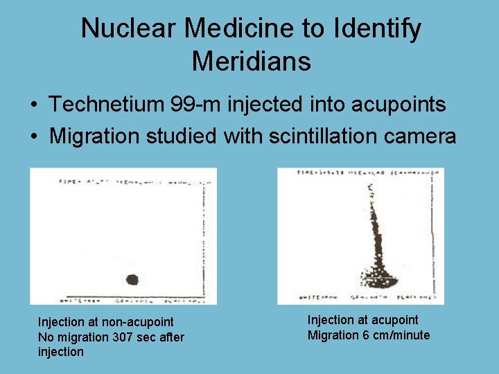 Nuclear Medicine to Identify Meridians • Technetium 99 -m injected into acupoints • Migration