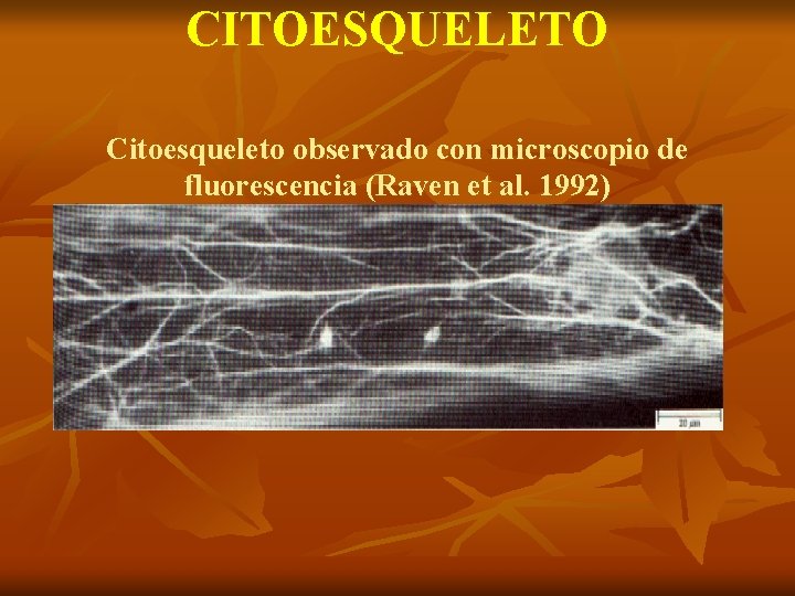 CITOESQUELETO Citoesqueleto observado con microscopio de fluorescencia (Raven et al. 1992) 