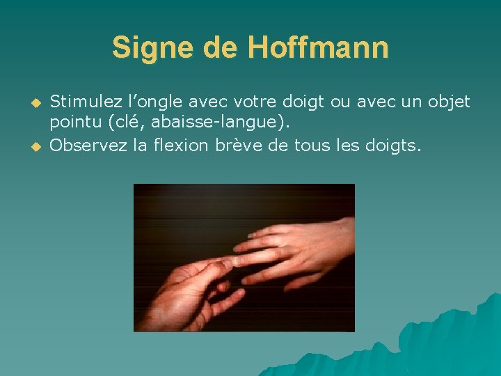 Signe de Hoffmann u u Stimulez l’ongle avec votre doigt ou avec un objet