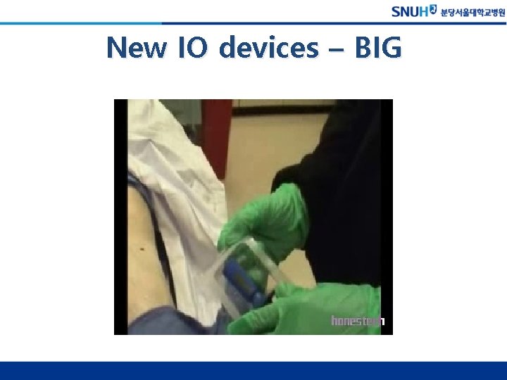 New IO devices – BIG 