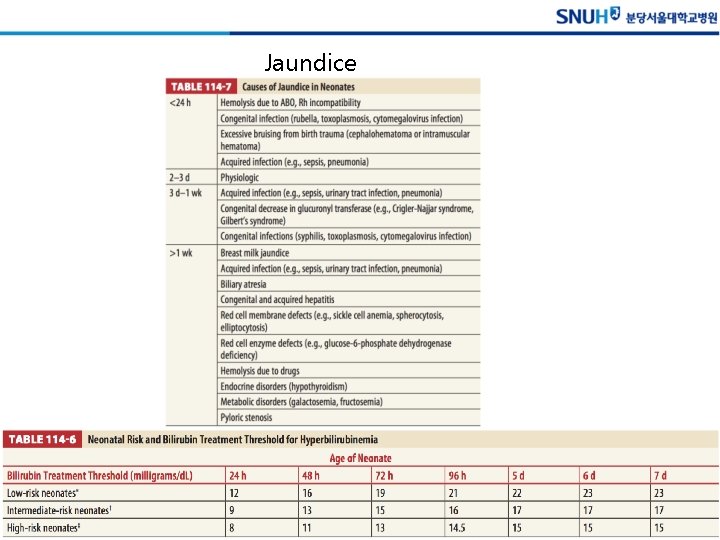 Jaundice 