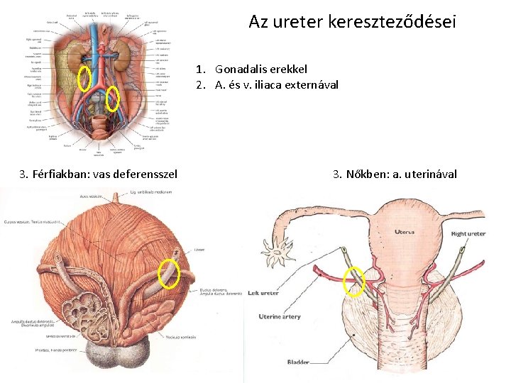 Az ureter kereszteződései 1. Gonadalis erekkel 2. A. és v. iliaca externával 3. Férfiakban: