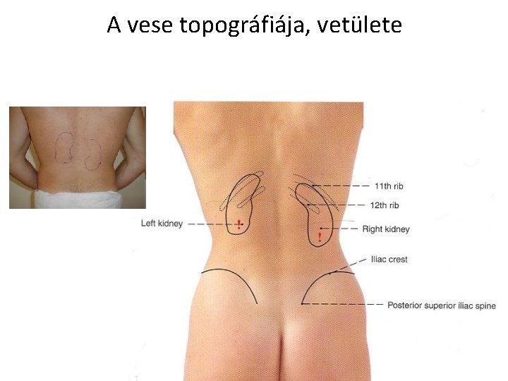 A vese topográfiája, vetülete 