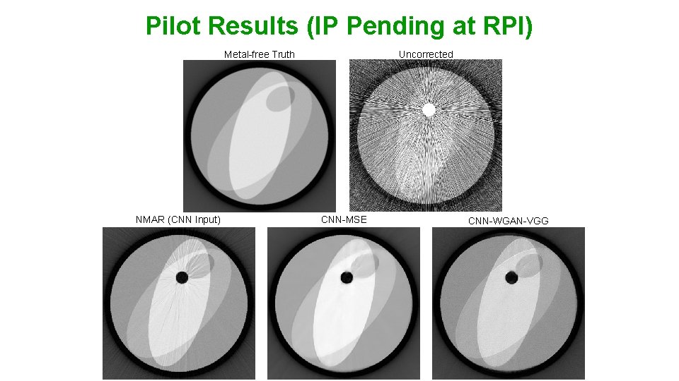 Pilot Results (IP Pending at RPI) Metal-free Truth NMAR (CNN Input) Uncorrected CNN-MSE CNN-WGAN-VGG