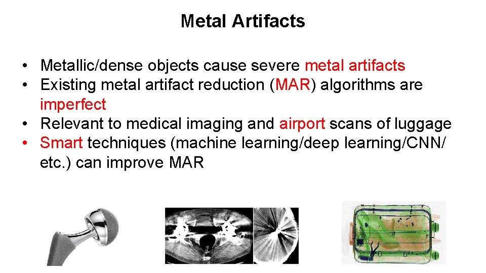 Metal Artifacts • Metallic/dense objects cause severe metal artifacts • Existing metal artifact reduction
