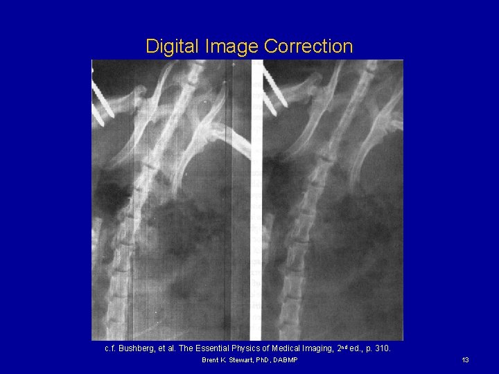 Digital Image Correction c. f. Bushberg, et al. The Essential Physics of Medical Imaging,