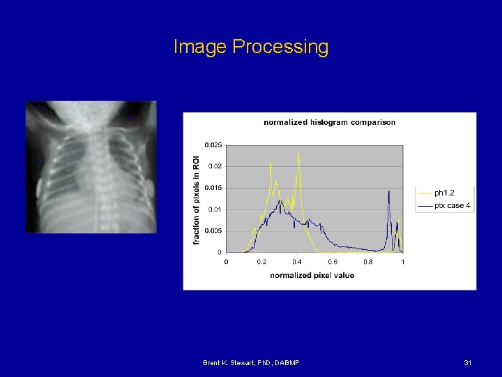 Image Processing Brent K. Stewart, Ph. D, DABMP 31 