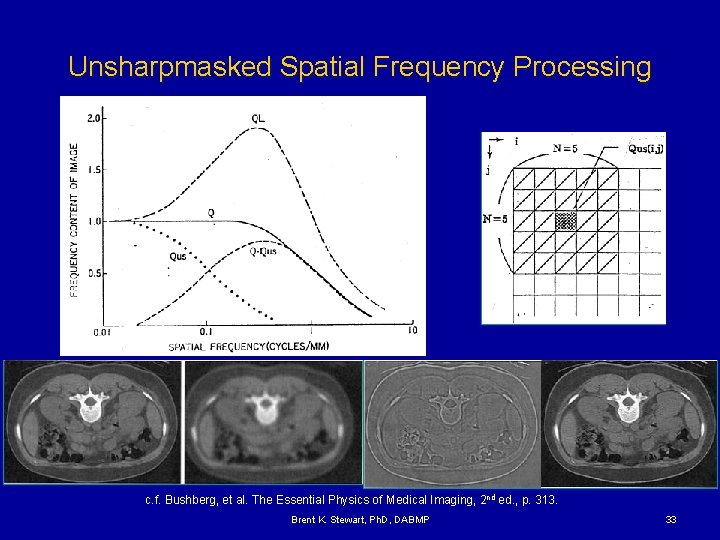 Unsharpmasked Spatial Frequency Processing c. f. Bushberg, et al. The Essential Physics of Medical
