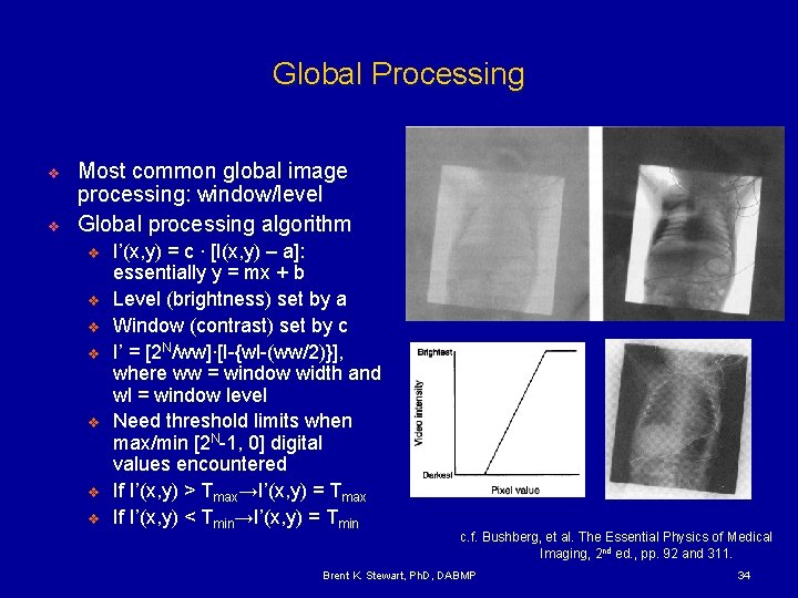 Global Processing v v Most common global image processing: window/level Global processing algorithm v