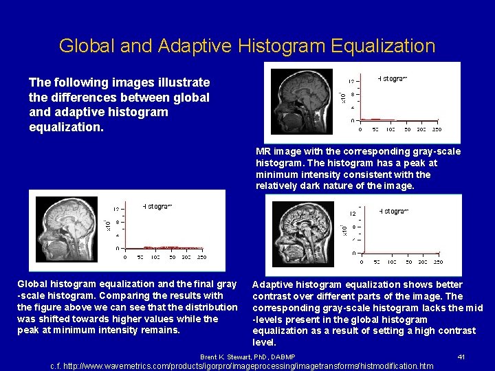 Global and Adaptive Histogram Equalization The following images illustrate the differences between global and