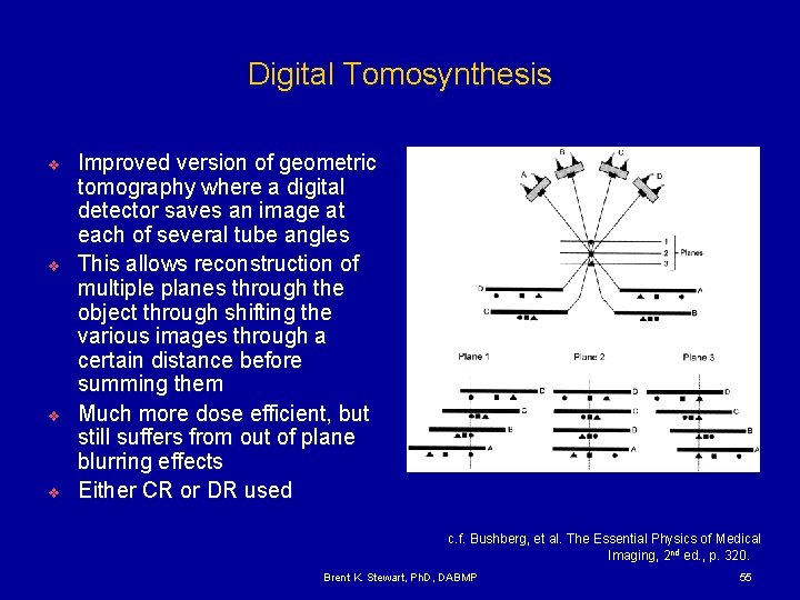 Digital Tomosynthesis v v Improved version of geometric tomography where a digital detector saves