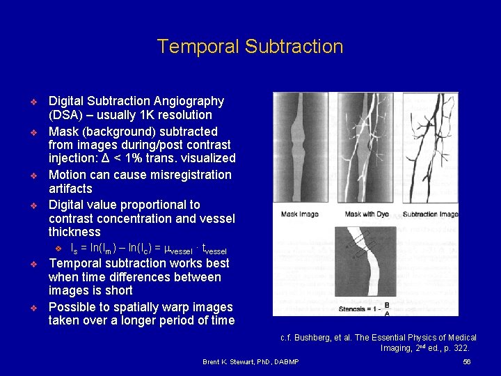 Temporal Subtraction v v Digital Subtraction Angiography (DSA) – usually 1 K resolution Mask