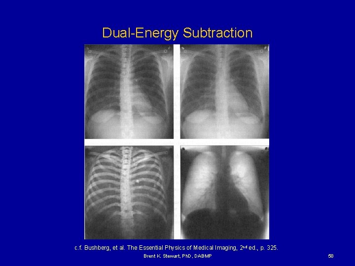 Dual-Energy Subtraction c. f. Bushberg, et al. The Essential Physics of Medical Imaging, 2