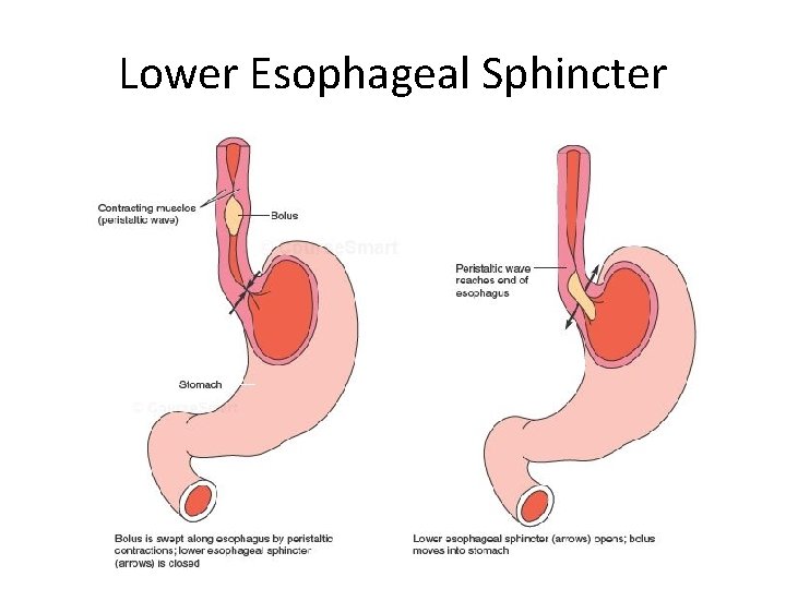 Lower Esophageal Sphincter 