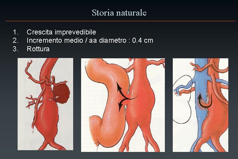 Storia naturale 1. 2. 3. Crescita imprevedibile Incremento medio / aa diametro : 0.