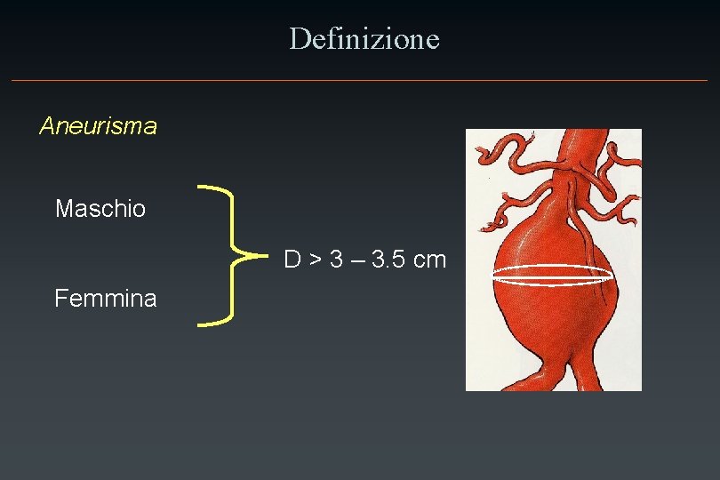 Definizione Aneurisma Maschio D > 3 – 3. 5 cm Femmina 
