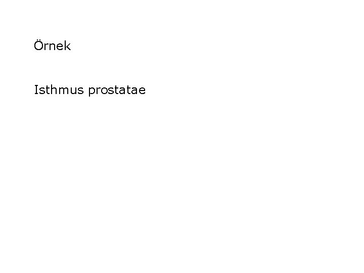 Örnek Isthmus prostatae 