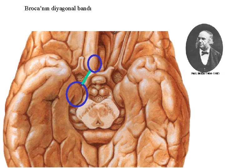 Broca’nın diyagonal bandı 