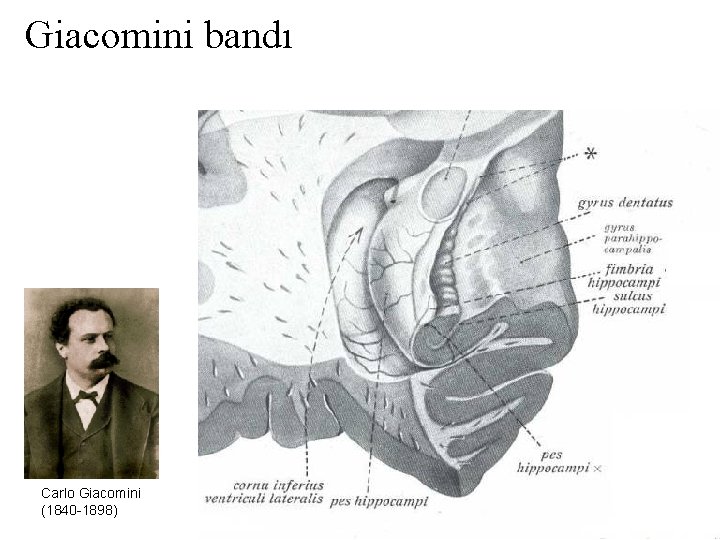 Giacomini bandı Carlo Giacomini (1840 -1898) 