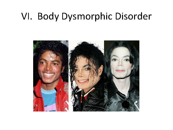 VI. Body Dysmorphic Disorder 