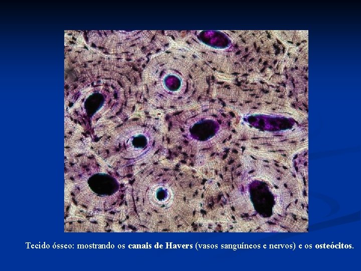 Tecido ósseo: mostrando os canais de Havers (vasos sanguíneos e nervos) e os osteócitos.