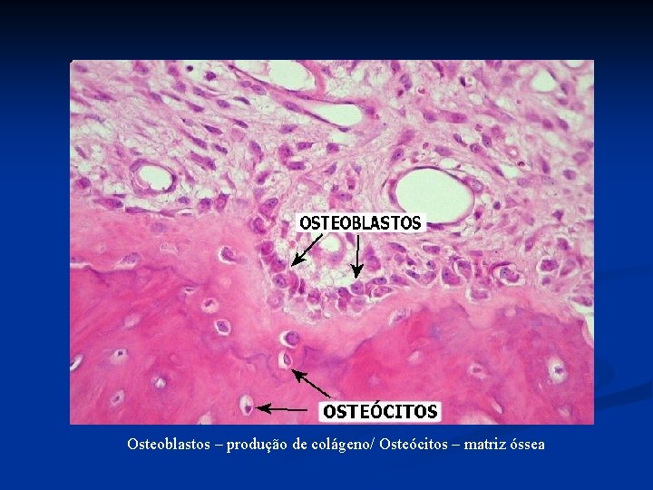 Osteoblastos – produção de colágeno/ Osteócitos – matriz óssea 