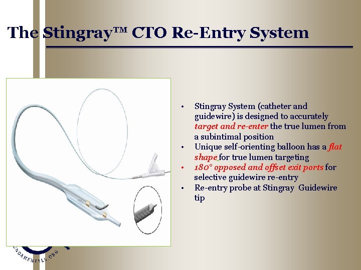 The Stingray™ CTO Re-Entry System • • Stingray System (catheter and guidewire) is designed