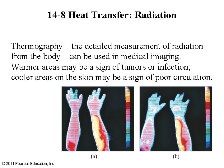 14 -8 Heat Transfer: Radiation Thermography—the detailed measurement of radiation from the body—can be