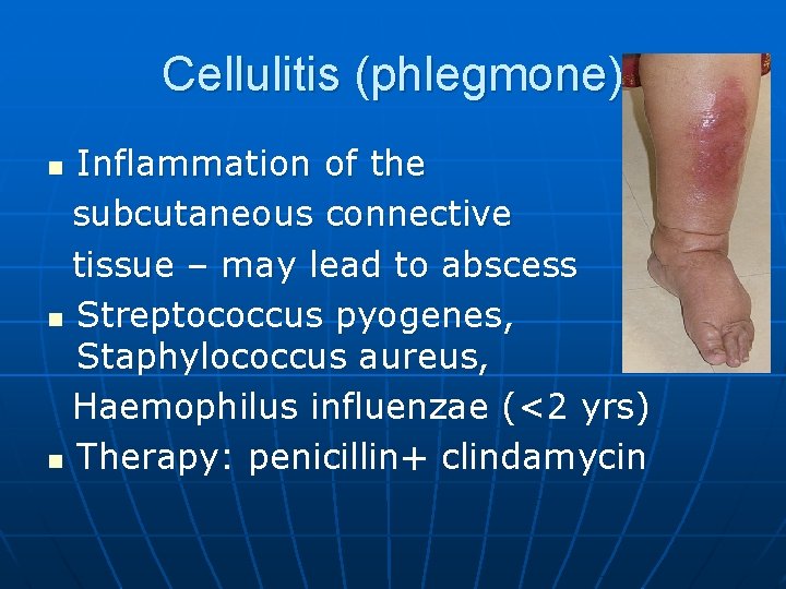 Cellulitis (phlegmone) Inflammation of the subcutaneous connective tissue – may lead to abscess n