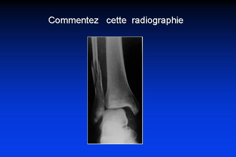 Commentez cette radiographie 