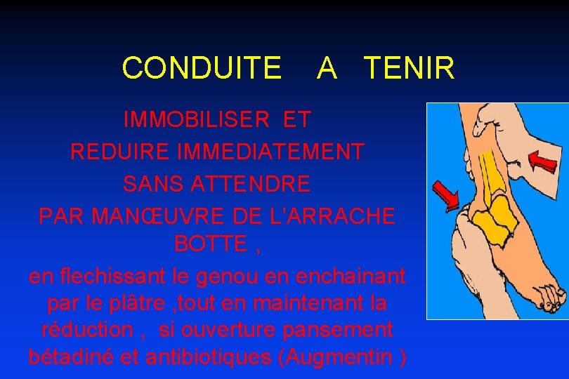 CONDUITE A TENIR IMMOBILISER ET REDUIRE IMMEDIATEMENT SANS ATTENDRE PAR MANŒUVRE DE L’ARRACHE BOTTE