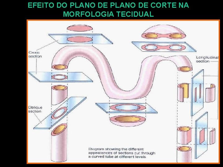 EFEITO DO PLANO DE CORTE NA MORFOLOGIA TECIDUAL 