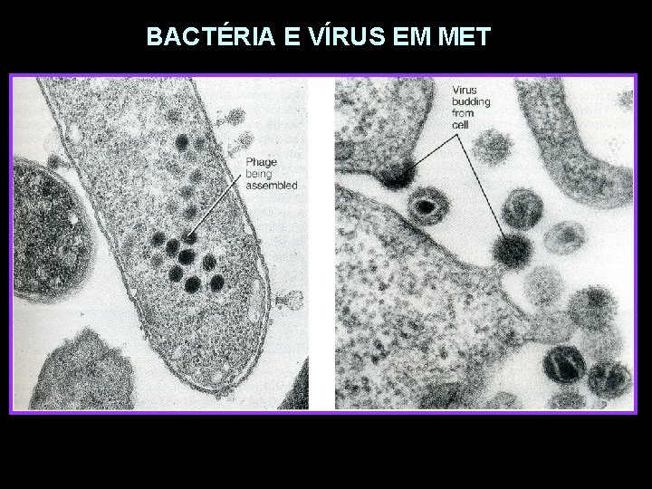 BACTÉRIA E VÍRUS EM MET 