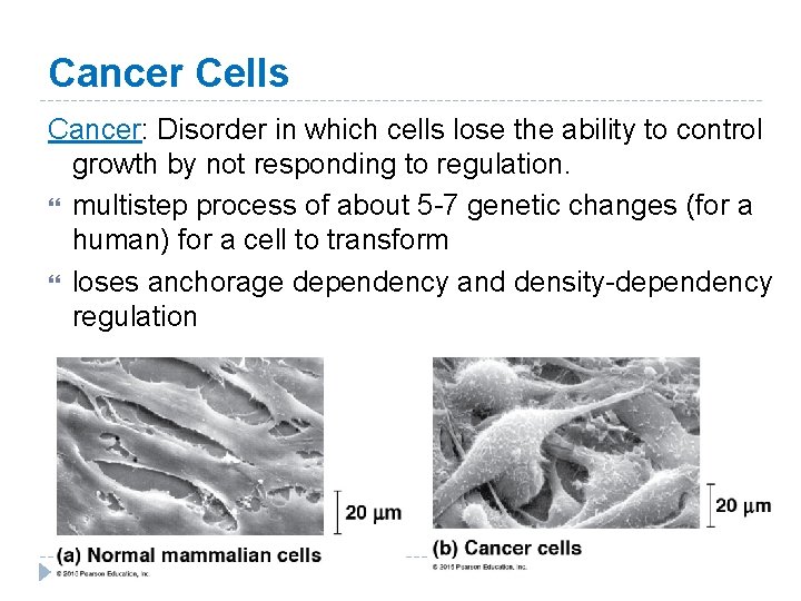 Cancer Cells Cancer: Disorder in which cells lose the ability to control growth by Cancer Cells Cancer: Disorder in which cells lose the ability to control growth by
