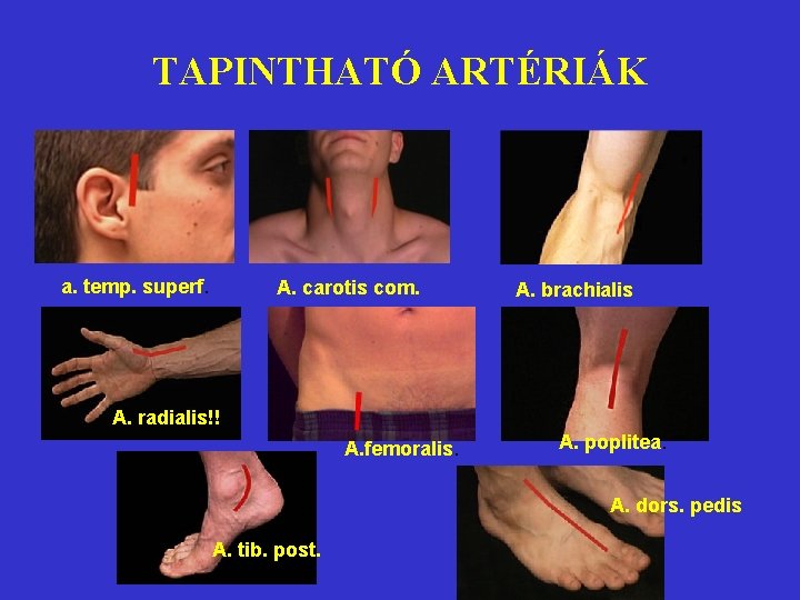 TAPINTHATÓ ARTÉRIÁK a. temp. superf. A. carotis com. A. brachialis A. radialis!!. A. femoralis.